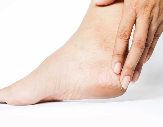 بهترین کرم ترک پا